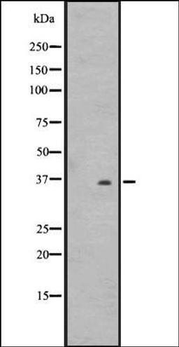 Western blot analysis of WiDr cell lysate HT1080 whole cell lysate using OR2T8/2T12/2T33 antibody