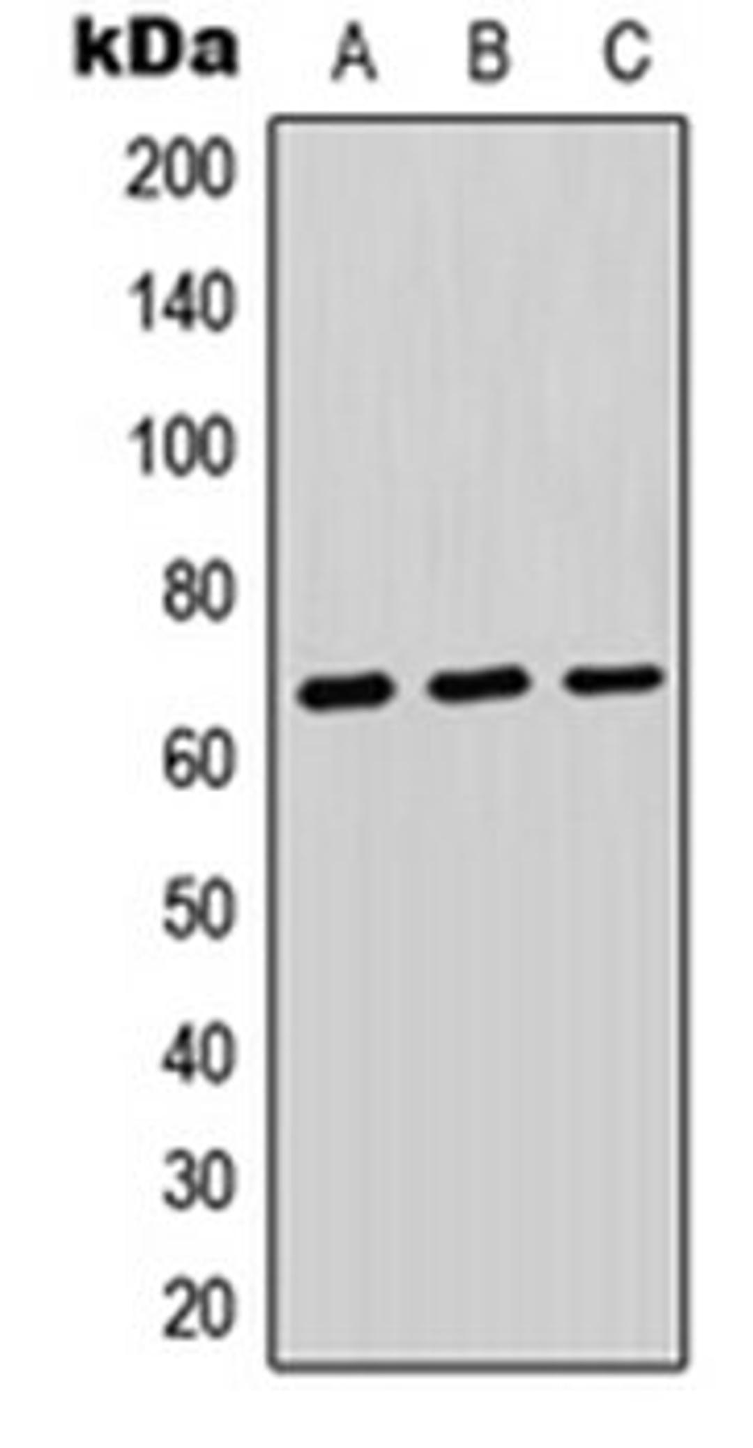 Western blot analysis of HEK293T (Lane 1), Raw264.7 (Lane 2), PC12 (Lane 3) whole cell lysates using PTPRK antibody