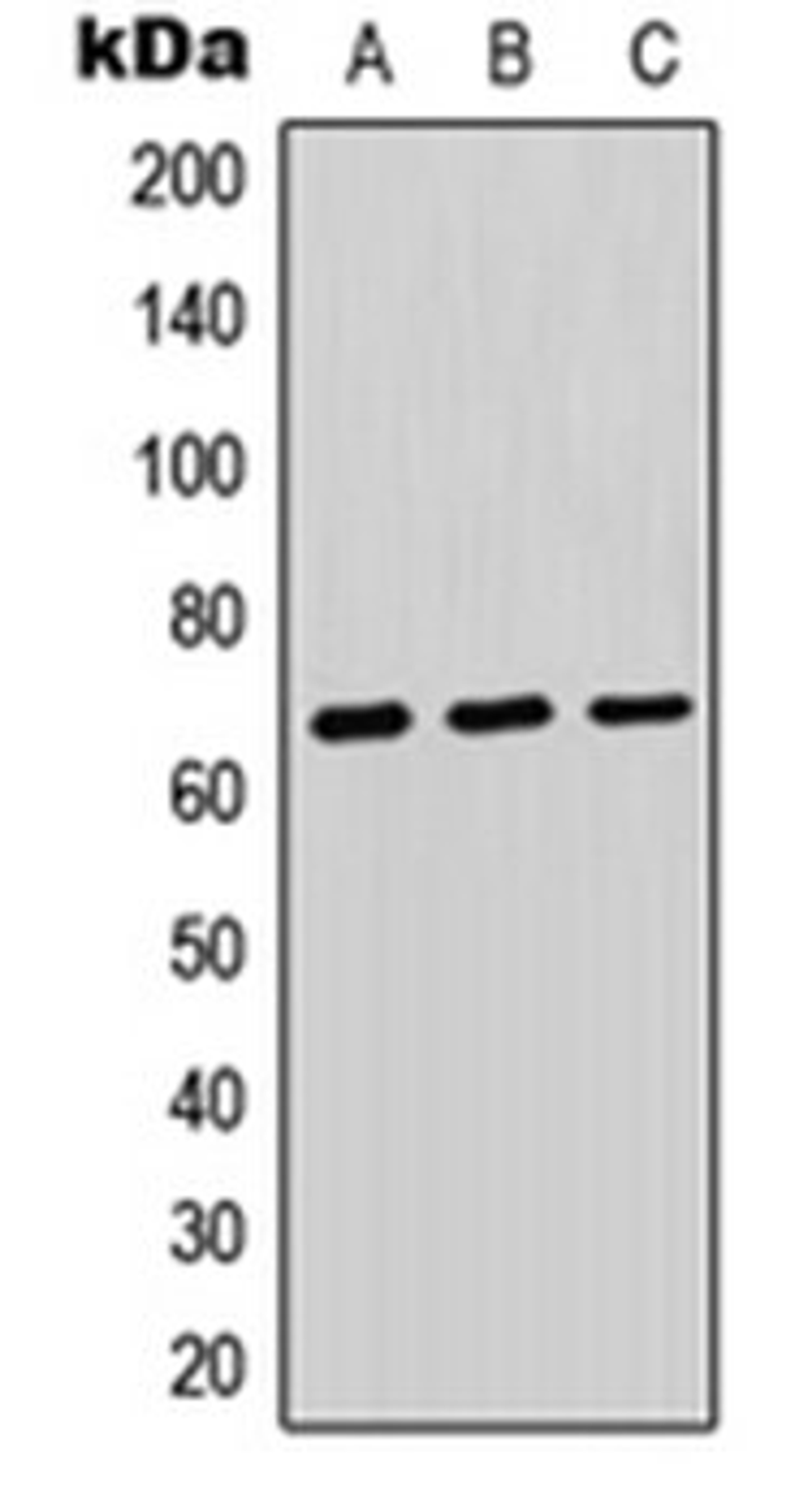 Western blot analysis of HEK293T (Lane 1), Raw264.7 (Lane 2), PC12 (Lane 3) whole cell lysates using PTPRK antibody