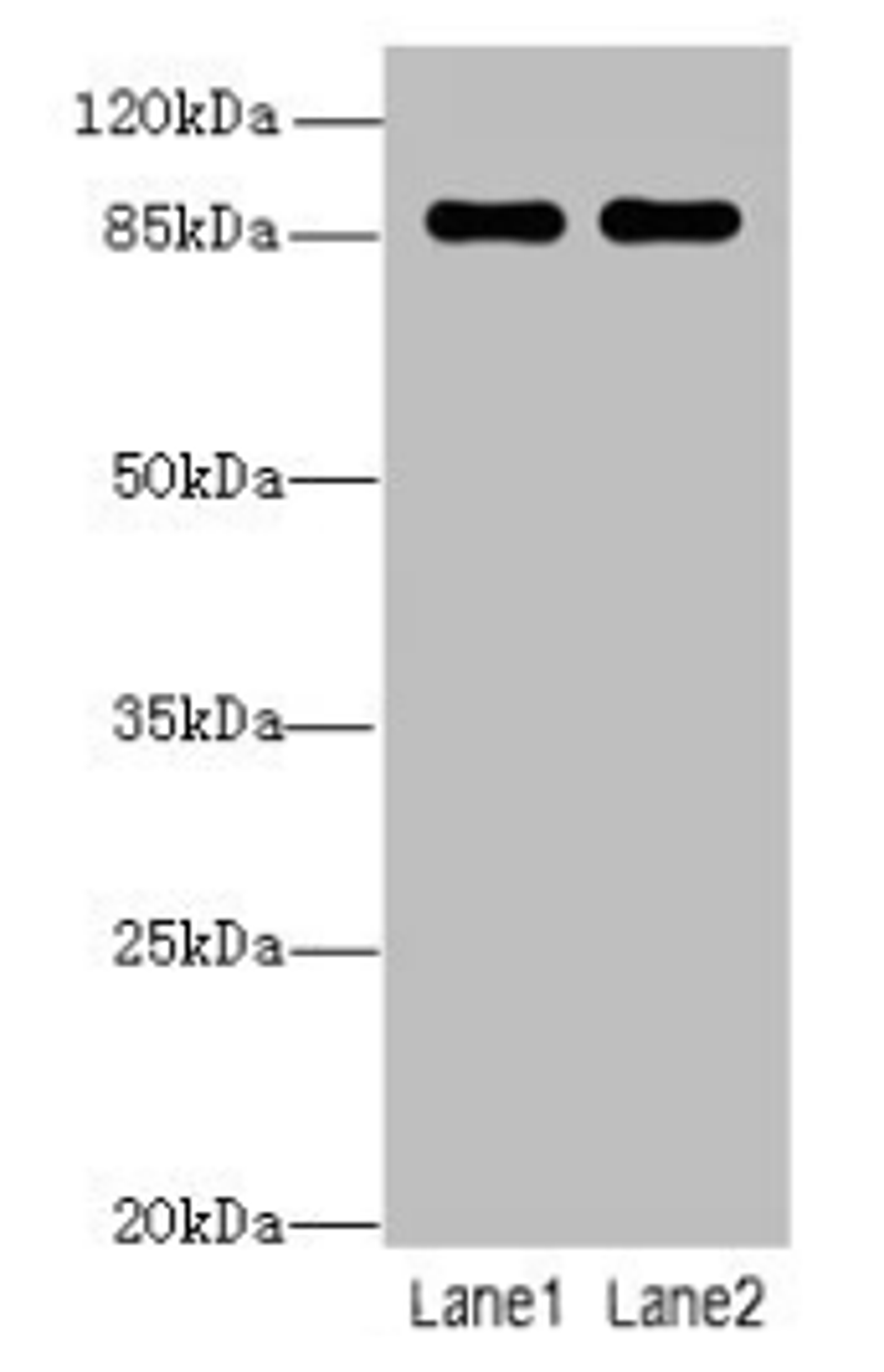 Western blot. All lanes: VWA5A antibody at 1µg/ml. Lane 1: A549 whole cell lysate. Lane 2: MCF-7 whole cell lysate. Secondary. Goat polyclonal to rabbit IgG at 1/10000 dilution. Predicted band size: 87, 48, 46, 30 kDa. Observed band size: 87 kDa