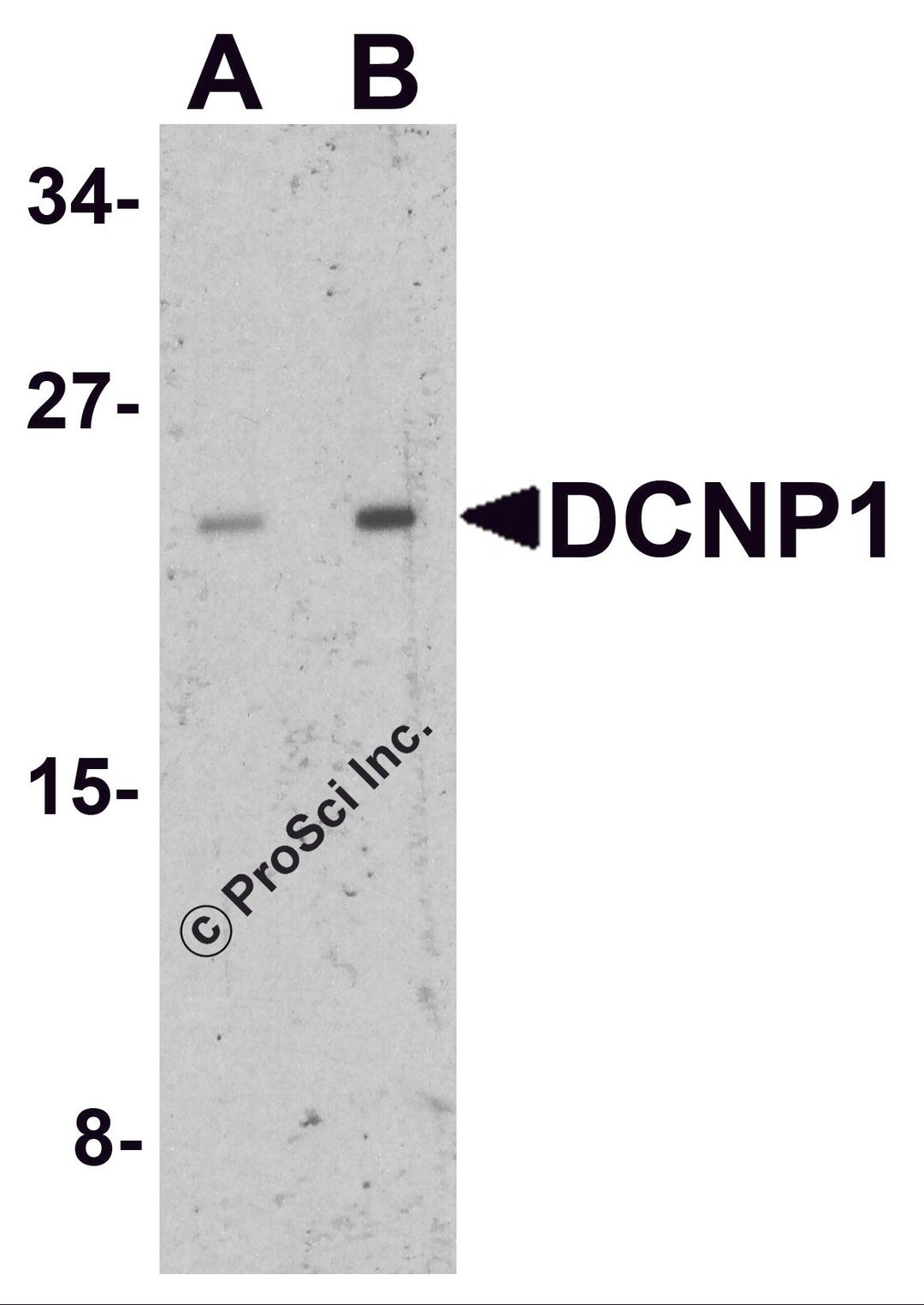 Western blot analysis of DCNP1 in mouse skeletal muscle tissue lysate with DCNP1 antibody at (A) 1 and (B) 2 &#956;g/ml.