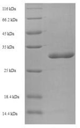 (Tris-Glycine gel) Discontinuous SDS-PAGE (reduced) with 5% enrichment gel and 15% separation gel.