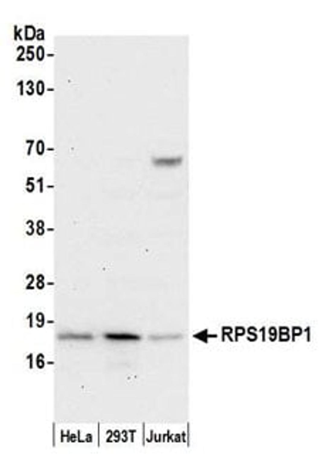 Detection of human RPS19BP1 by western blot.