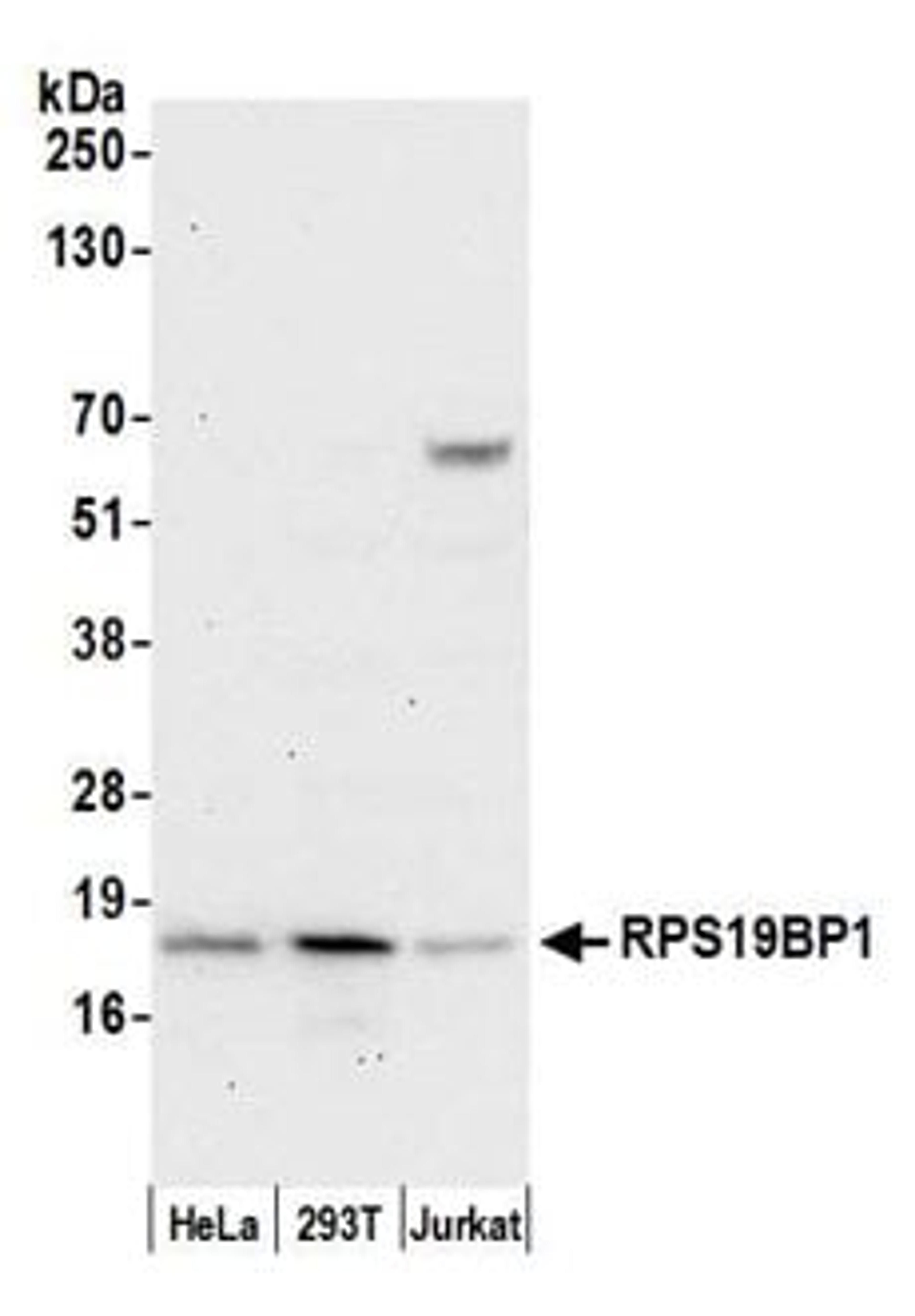 Detection of human RPS19BP1 by western blot.