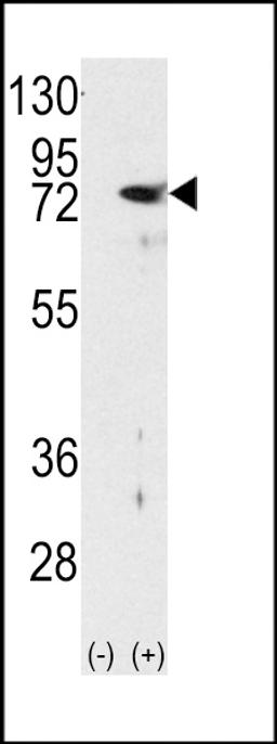 Western blot analysis of PKC delta using rabbit polyclonal PKC delta Antibody using 293 cell lysates (2 ug/lane) either nontransfected (Lane 1) or transiently transfected with the PRKCD gene (Lane 2).