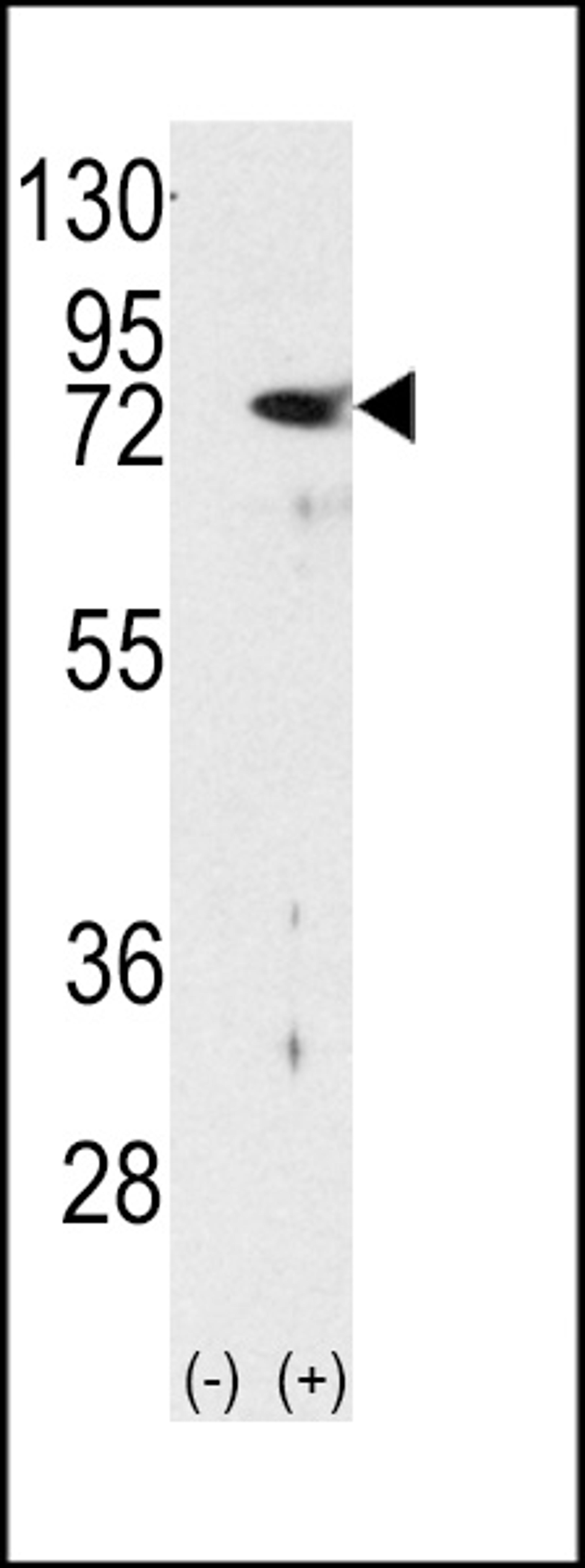 Western blot analysis of PKC delta using rabbit polyclonal PKC delta Antibody using 293 cell lysates (2 ug/lane) either nontransfected (Lane 1) or transiently transfected with the PRKCD gene (Lane 2).