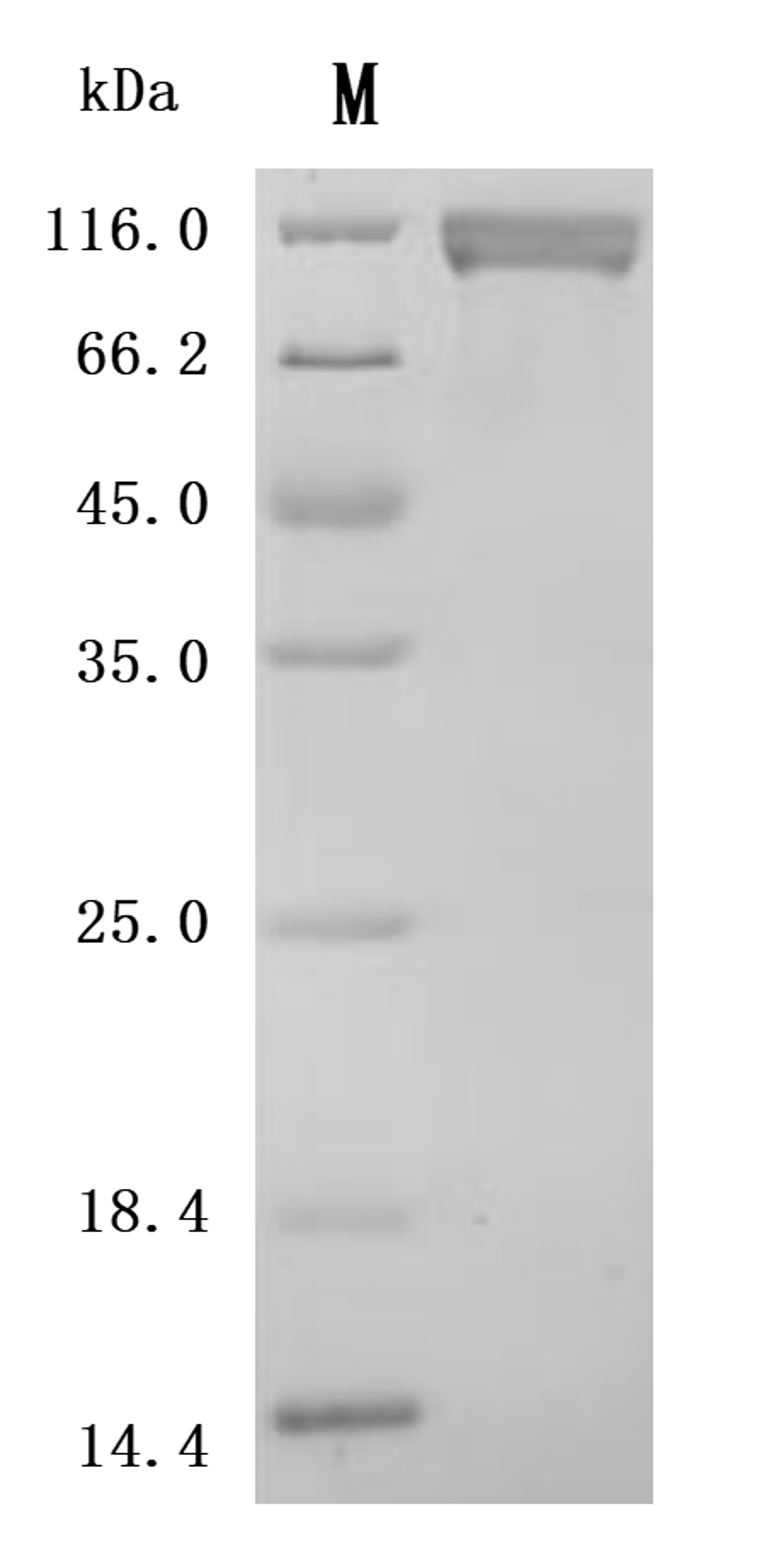 (Tris-Glycine gel) Discontinuous SDS-PAGE (reduced) with 5% enrichment gel and 15% separation gel.