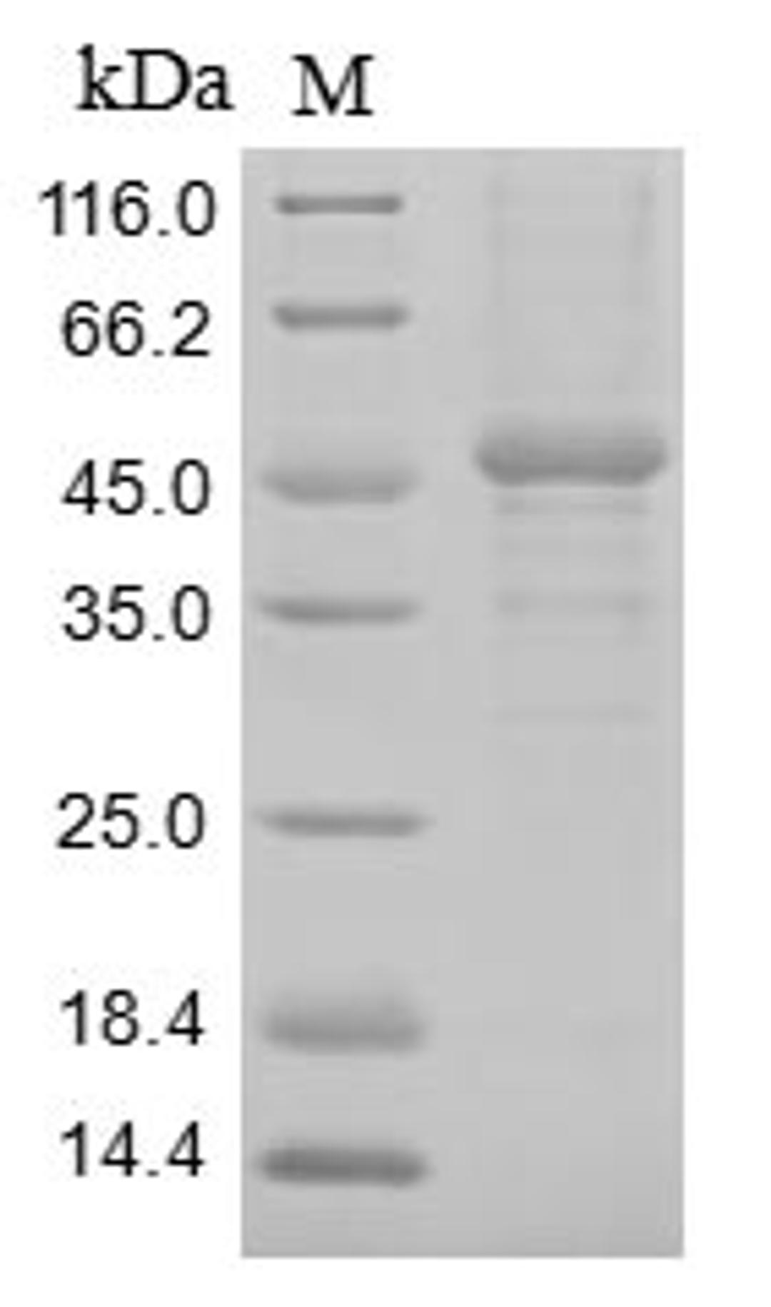 (Tris-Glycine gel) Discontinuous SDS-PAGE (reduced) with 5% enrichment gel and 15% separation gel.