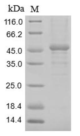 (Tris-Glycine gel) Discontinuous SDS-PAGE (reduced) with 5% enrichment gel and 15% separation gel.
