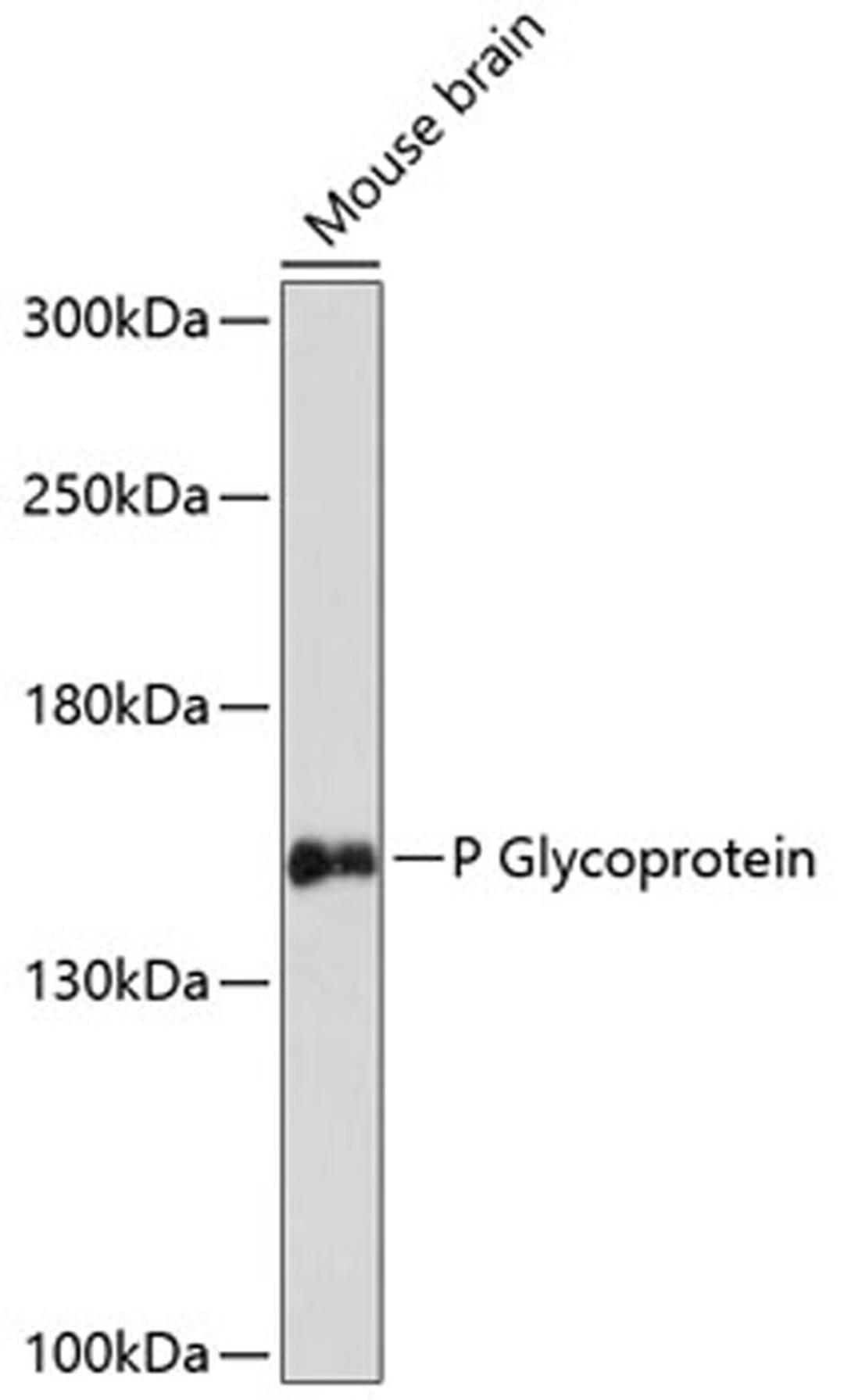 Western blot - P Glycoprotein antibody (A14765)