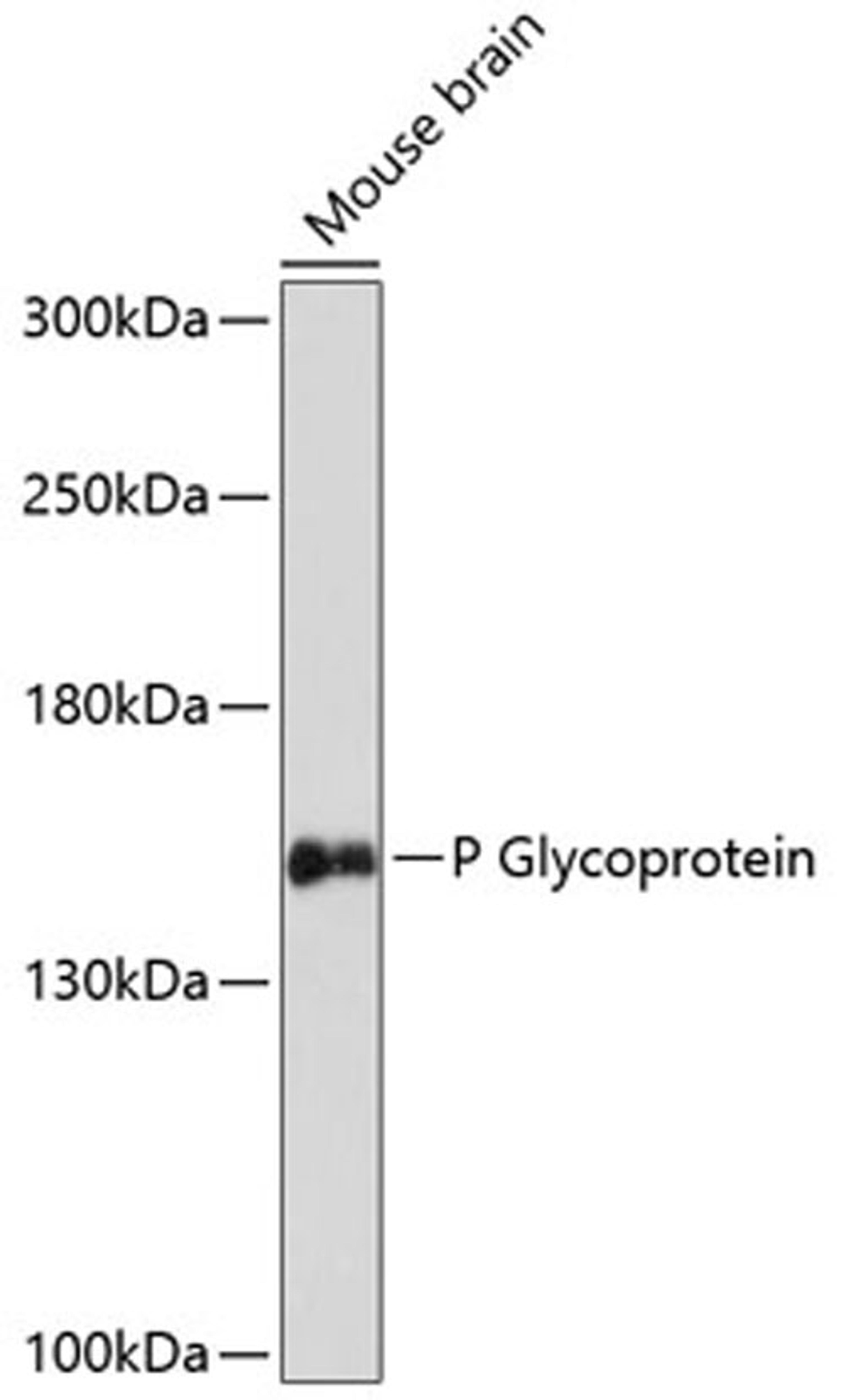 Western blot - P Glycoprotein antibody (A14765)