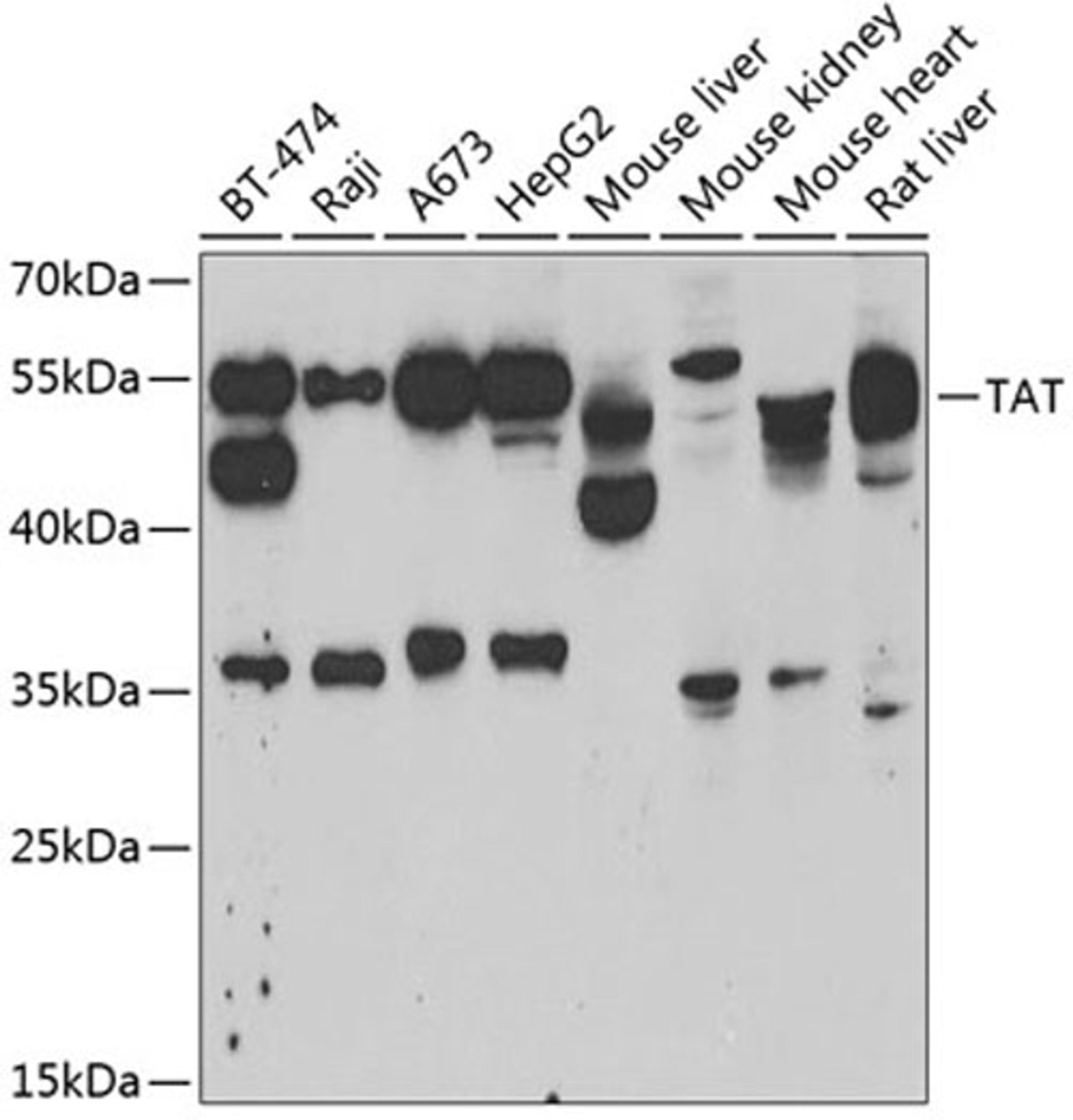 Western blot - TAT antibody (A6764)