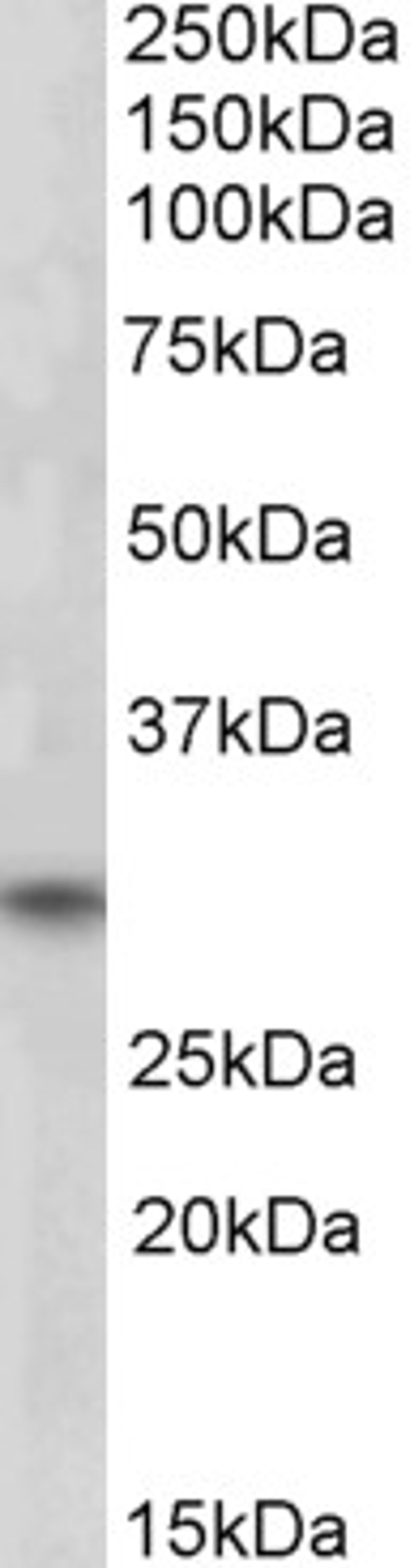 46-934 (1ug/ml) staining of Human Skeletal Muscle lysate (35ug protein in RIPA buffer). Primary incubation was 1 hour. Detected by chemiluminescence.