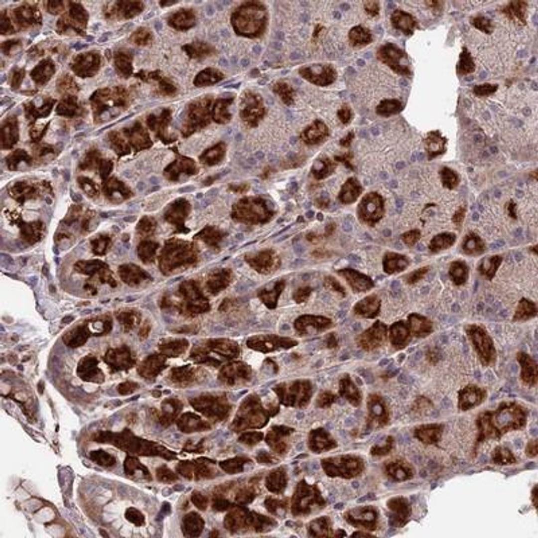 Immunohistochemistry: SEH1L Antibody [NBP1-80773] - Staining of human stomach, lower shows strong cytoplasmic positivity in glandular cells.