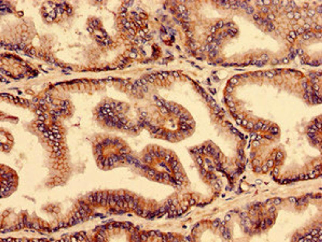 Immunohistochemistry analysis of human prostate tissue using CSB-PA688542LA01HU at dilution of 1:100