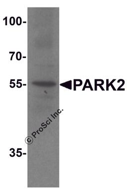 Western blot analysis of PARK2 in human cerebellum tissue lysate with PARK2 antibody at 1 μg/ml.