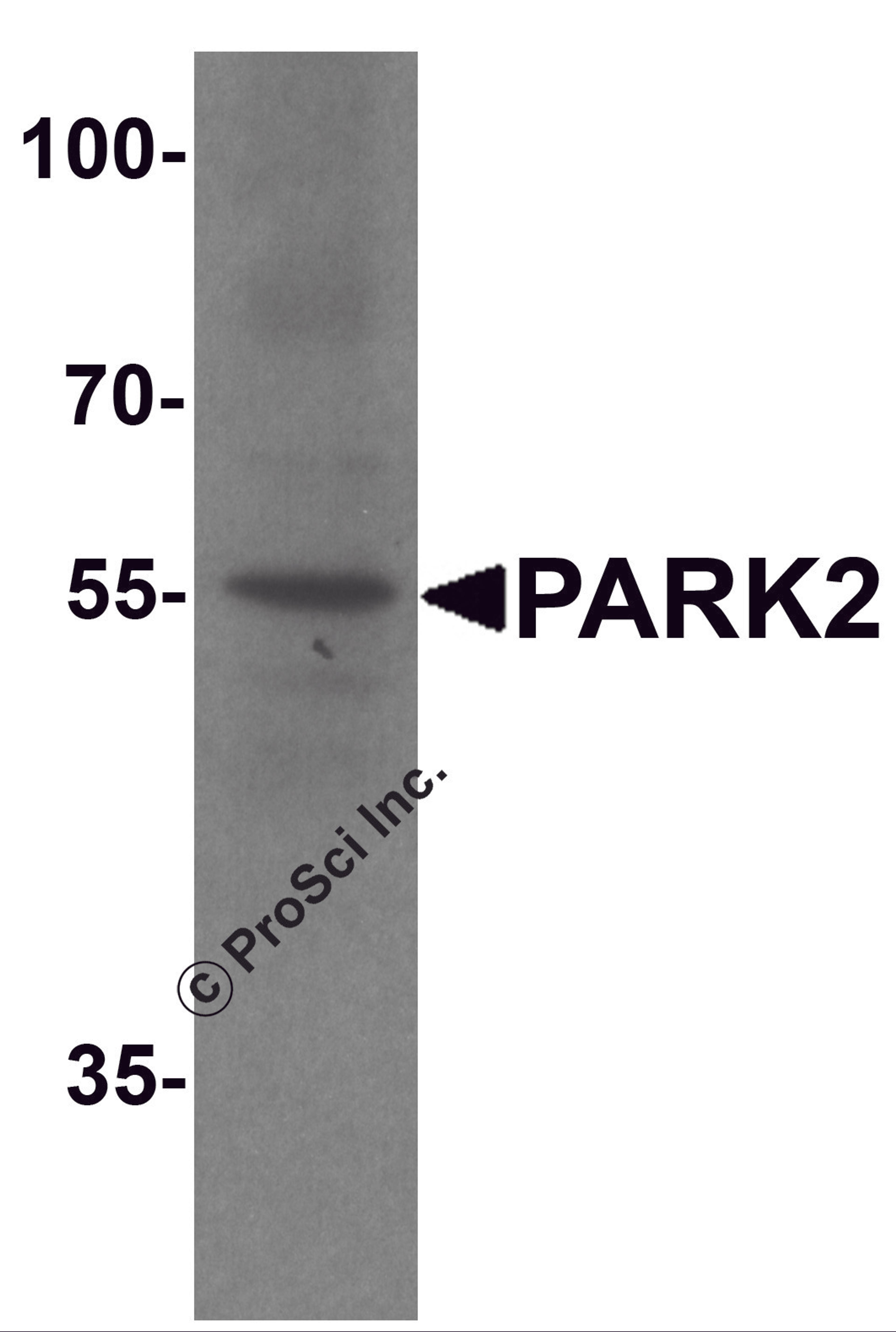 Western blot analysis of PARK2 in human cerebellum tissue lysate with PARK2 antibody at 1 μg/ml.