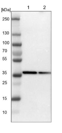 Western Blot: CSRNP3 Antibody [NBP1-83933] - Lane 1: NIH-3T3 cell lysate (Mouse embryonic fibroblast cells)<br/>Lane 2: NBT-II cell lysate (Rat Wistar bladder tumour cells)