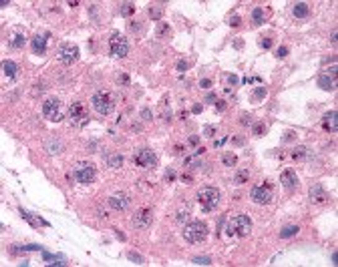 Immunohistochemistry staining of MAGEA2 in testis (formalin-fixed paraffin embedded) tissue using MAGEA2 Antibody.