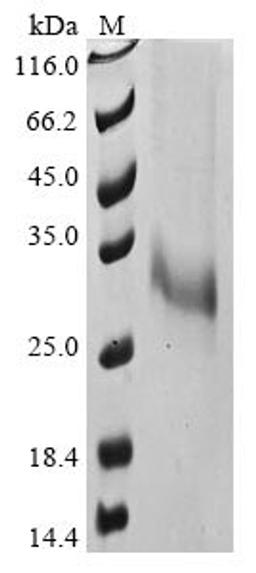 (Tris-Glycine gel) Discontinuous SDS-PAGE (reduced) with 5% enrichment gel and 15% separation gel.