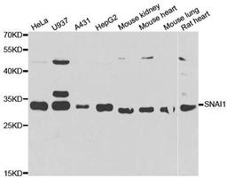 WB analysis of extracts of various cell lines using SNAI1 antibody