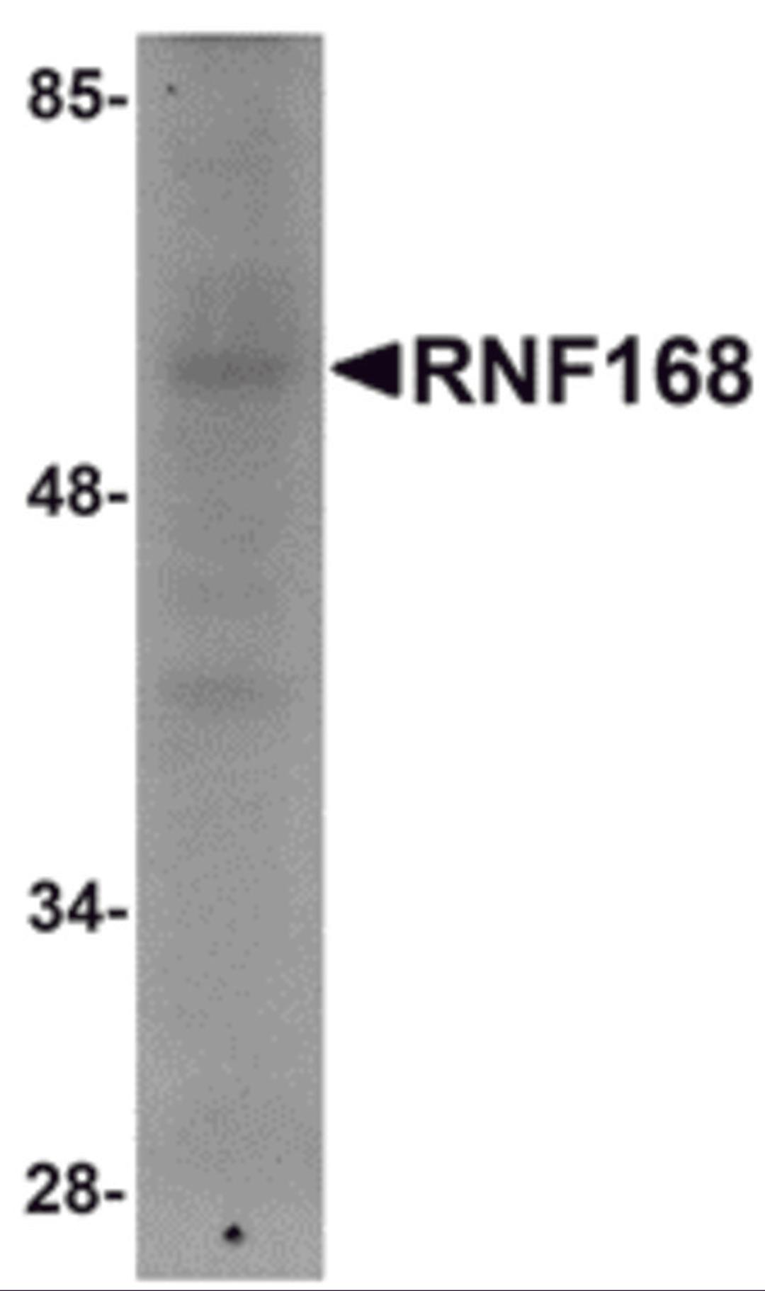 Western blot analysis of RNF168 in human brain tissue lysate with RNF168 antibody at 1 μg/mL.