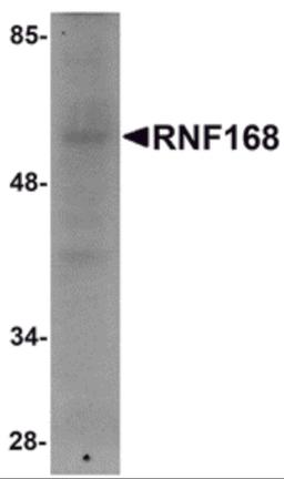 Western blot analysis of RNF168 in human brain tissue lysate with RNF168 antibody at 1 μg/mL.