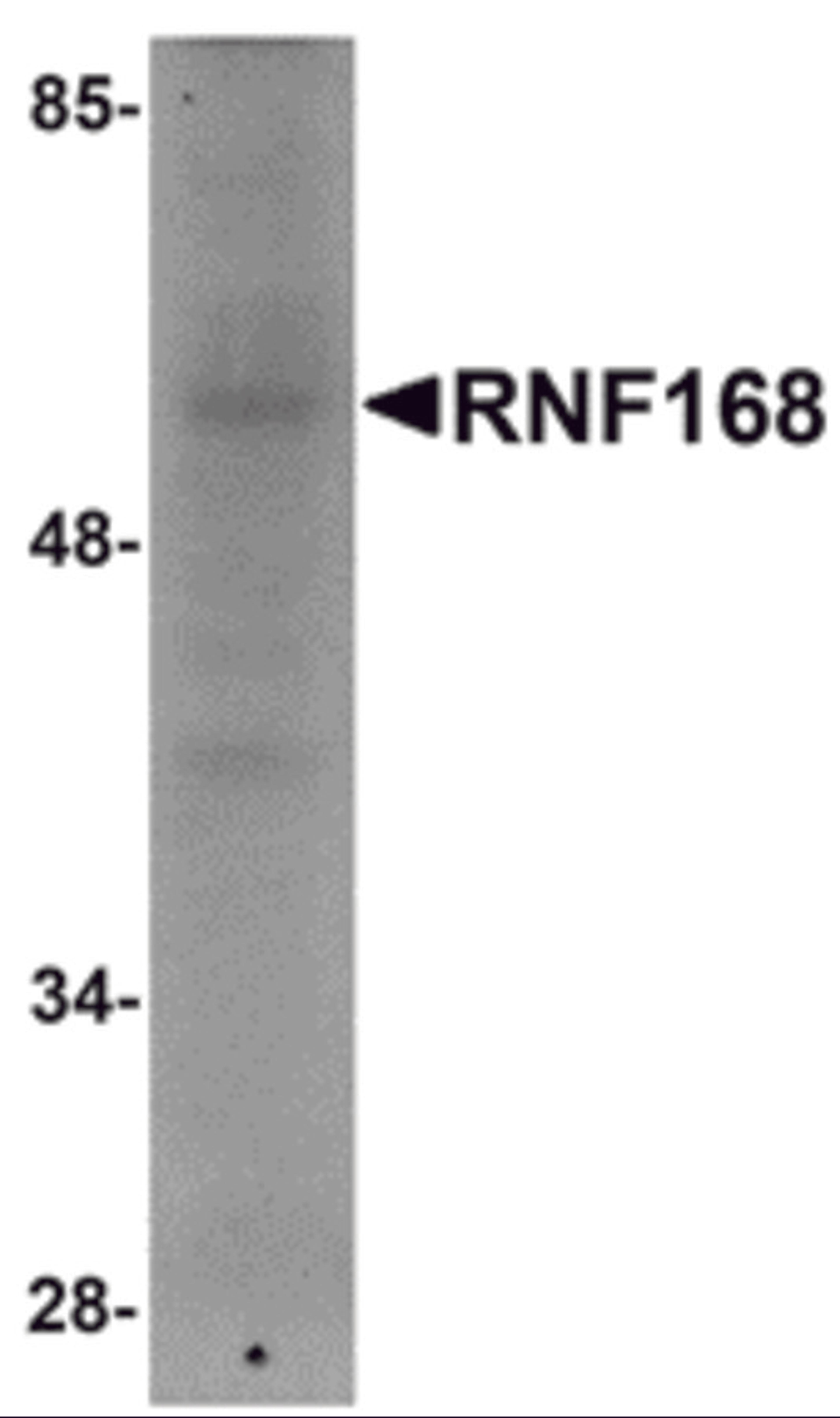 Western blot analysis of RNF168 in human brain tissue lysate with RNF168 antibody at 1 μg/mL.