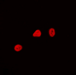 Immunofluorescence analysis of HEK293T cells using CDCA4 antibody