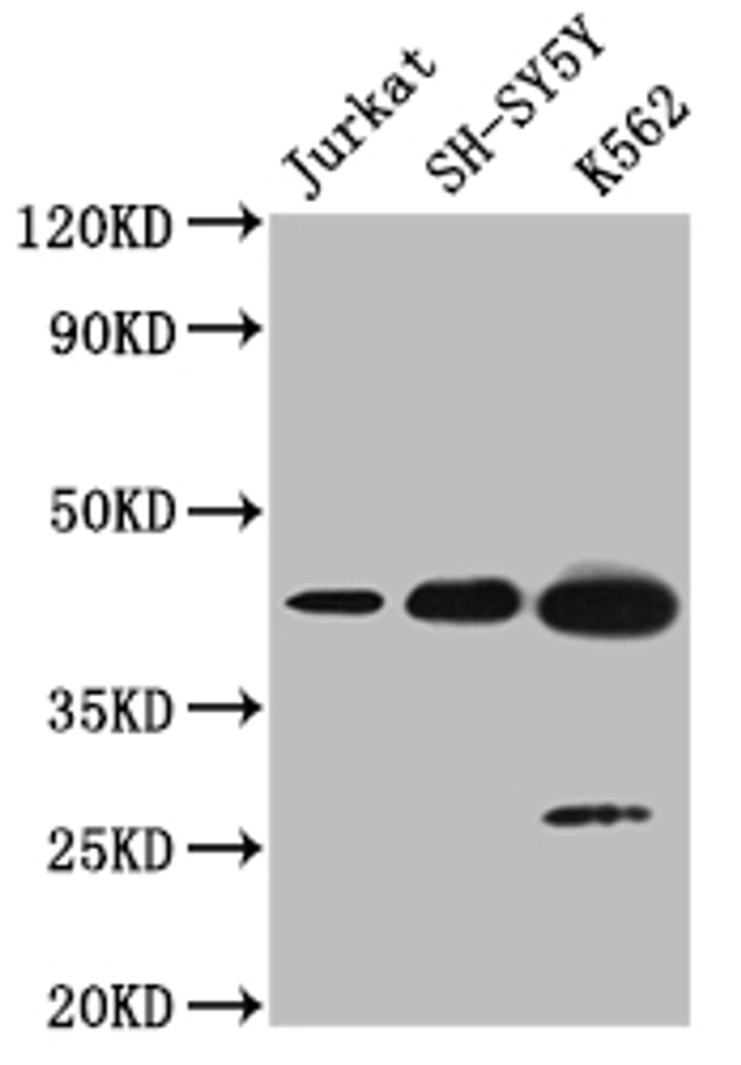 Western blot. All lanes: NSUN4 antibody at 0.6ug/ml + 293T whole cell lysate. Secondary. Goat polyclonal to rabbit at 1/10000 dilution. Predicted band size: 44, 17, 22, 38 kDa. Observed band size: 44 kDa. 