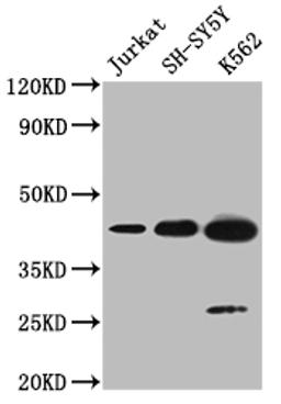 Western blot. All lanes: NSUN4 antibody at 0.6ug/ml + 293T whole cell lysate. Secondary. Goat polyclonal to rabbit at 1/10000 dilution. Predicted band size: 44, 17, 22, 38 kDa. Observed band size: 44 kDa. 