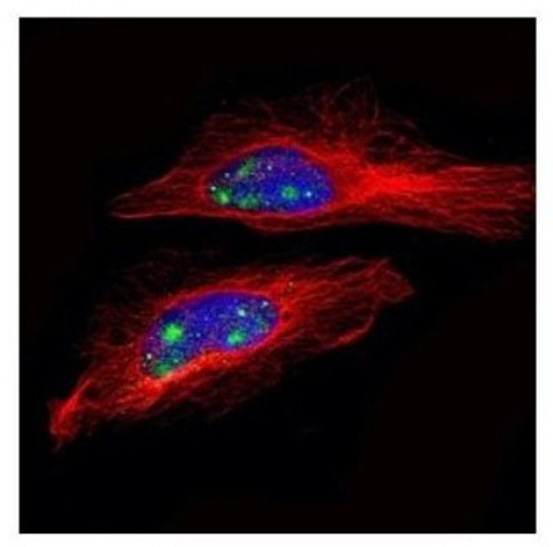 Immunocytochemistry/Immunofluorescence: SNRPD2 Antibody [NBP2-20438] - Confocal immunofluorescence analysis of paraformaldehyde-fixed HeLa, using SNRPD2 antibody (Green) at 1:500 dilution. Alpha-tubulin filaments are labeled with Alpha-tubulin antibody (Red) at 1:2000.