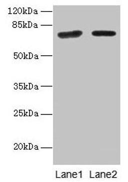 Western blot. All lanes: KLHL22 antibody at 8µg/ml. Lane 1: Jurkat whole cell lysate. Lane 2: NIH/3T3 whole cell lysate. Secondary. Goat polyclonal to rabbit IgG at 1/10000 dilution. Predicted band size: 72, 56 kDa. Observed band size: 72 kDa
