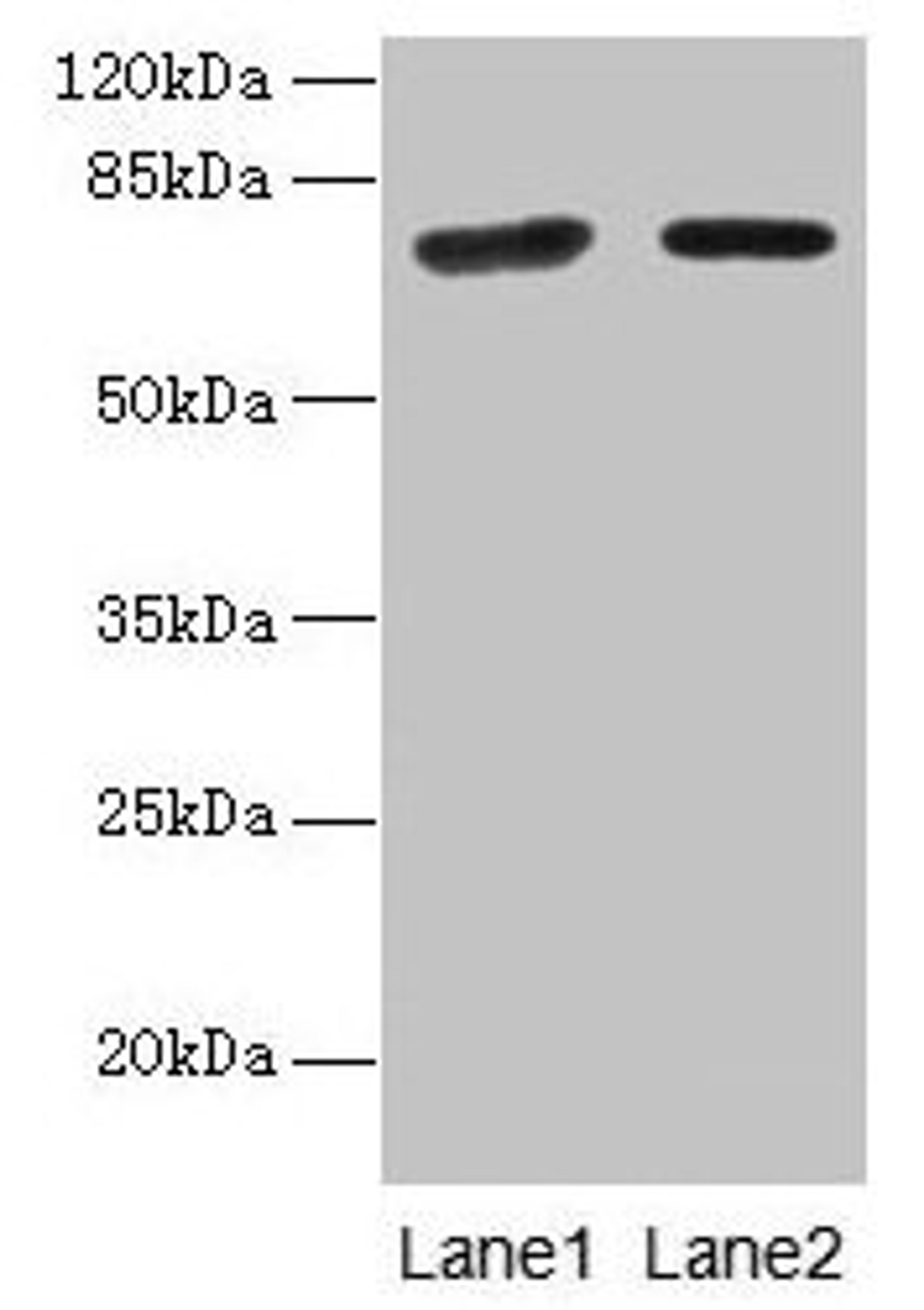 Western blot. All lanes: KLHL22 antibody at 8µg/ml. Lane 1: Jurkat whole cell lysate. Lane 2: NIH/3T3 whole cell lysate. Secondary. Goat polyclonal to rabbit IgG at 1/10000 dilution. Predicted band size: 72, 56 kDa. Observed band size: 72 kDa