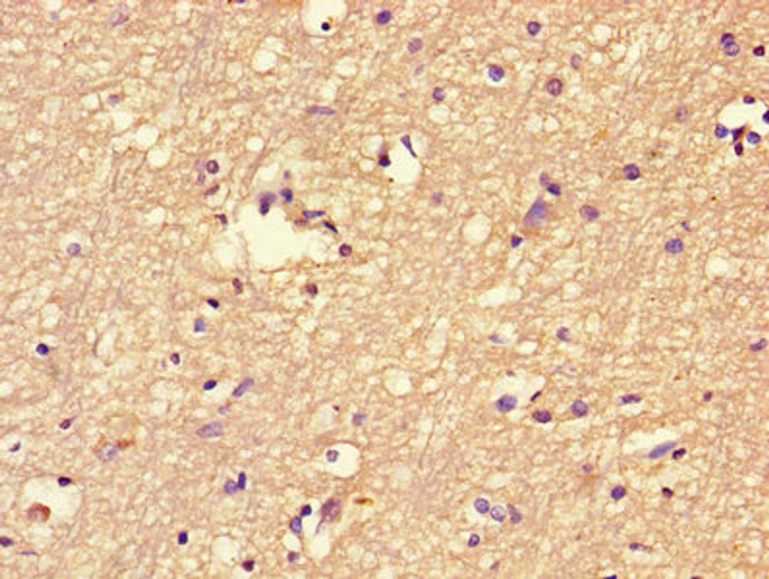 Immunohistochemistry of paraffin-embedded human brain tissue using CSB-PA008469LA01HU at dilution of 1:100