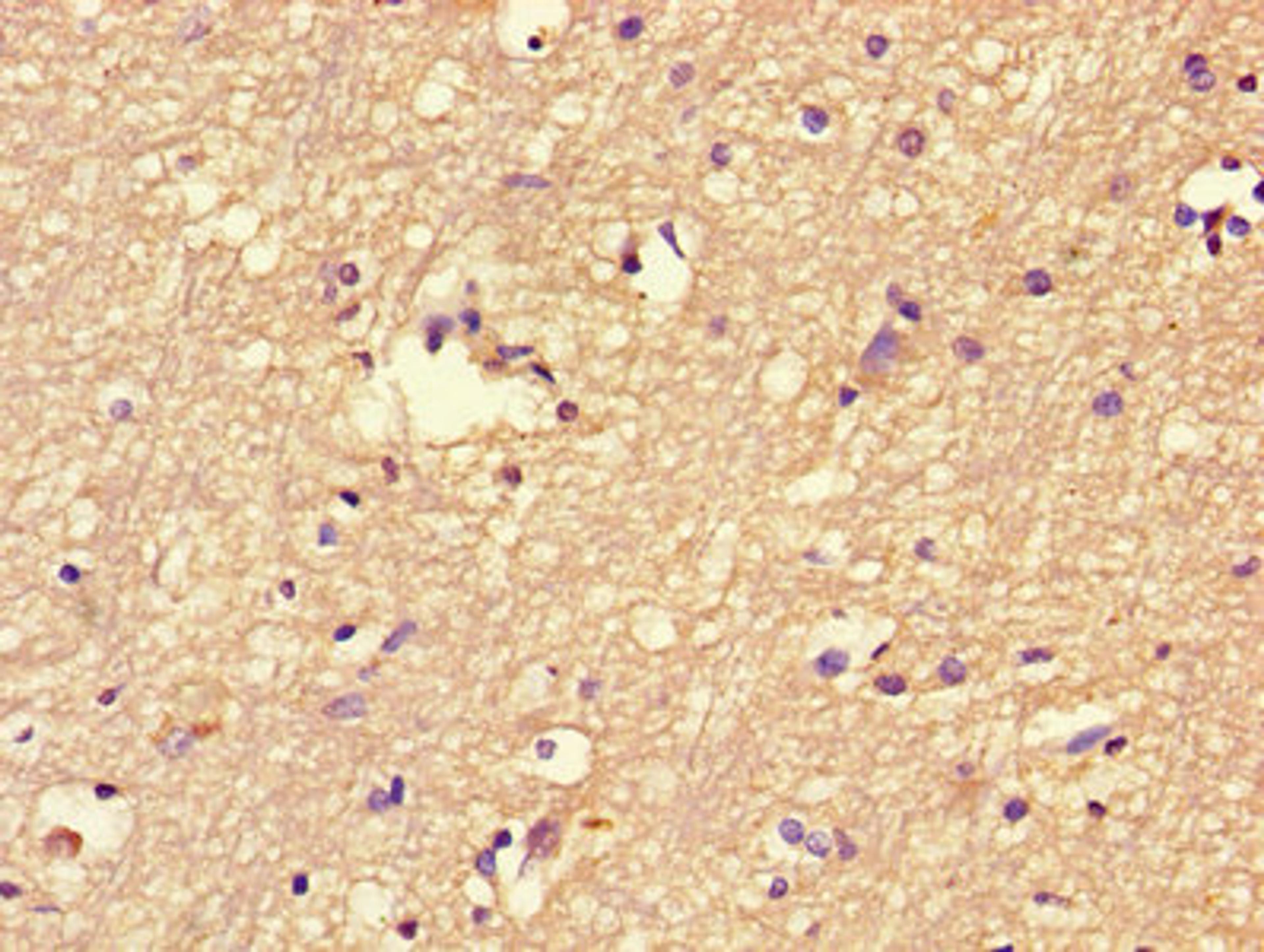 Immunohistochemistry of paraffin-embedded human brain tissue using CSB-PA008469LA01HU at dilution of 1:100