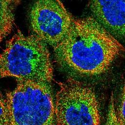 Immunocytochemistry/Immunofluorescence: DENND4C Antibody [NBP1-90788] - Staining of human cell line A-431 shows positivity in cytoplasm, golgi apparatus & vesicles.