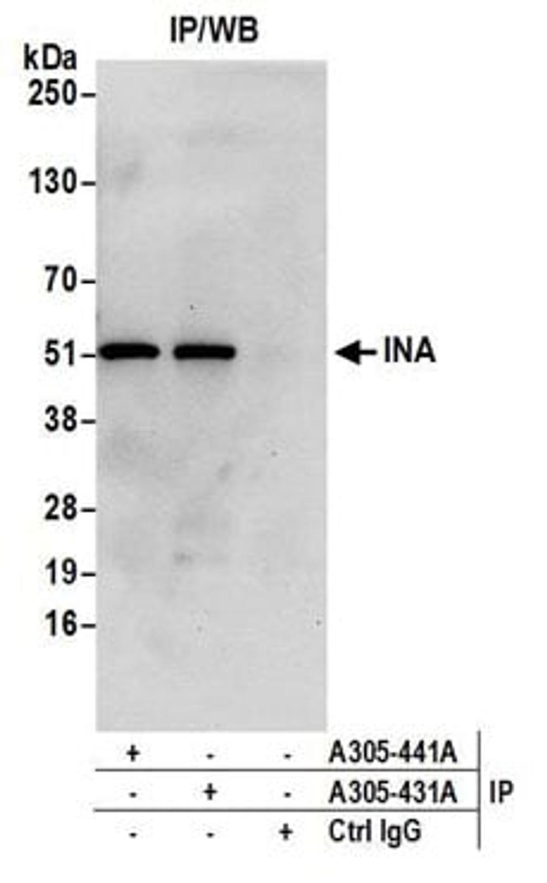 Detection of human INA by western blot of immunoprecipitates.