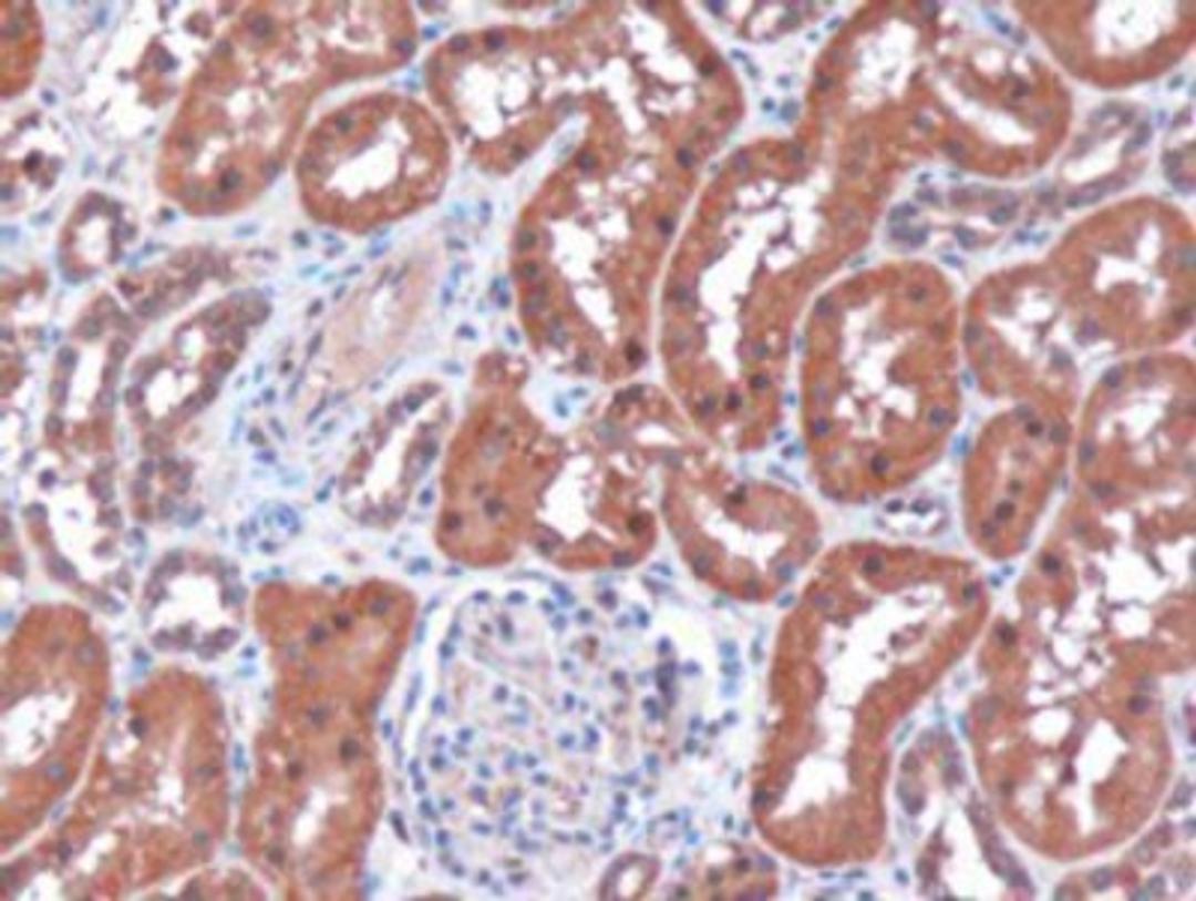 Immunohistochemistry: Renalase Antibody [NB100-1493] - (3ug/ml) staining of paraffin embedded Human Kidney. Microwaved antigen retrieval with citrate buffer pH 6, HRP-staining.