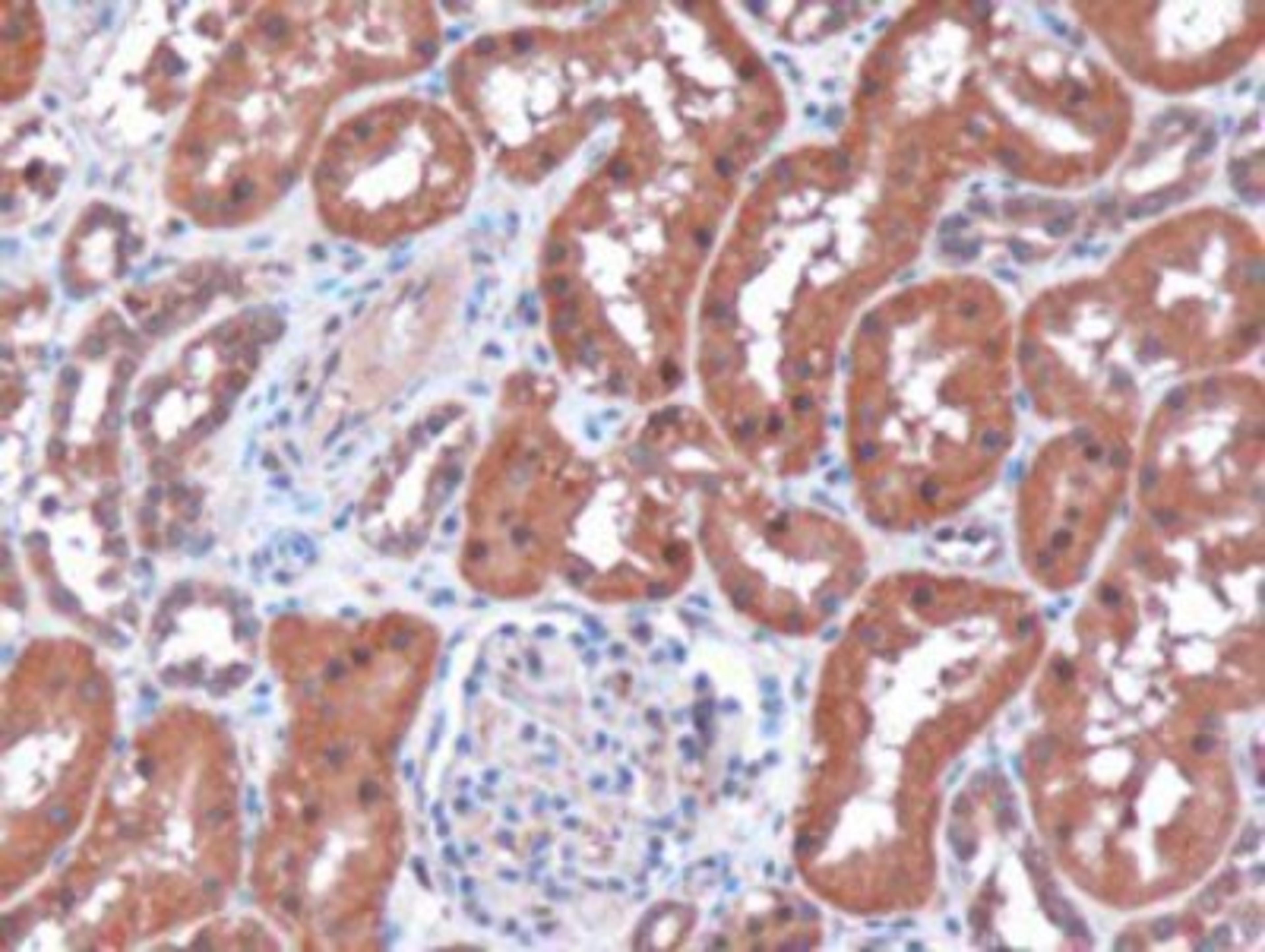 Immunohistochemistry: Renalase Antibody [NB100-1493] - (3ug/ml) staining of paraffin embedded Human Kidney. Microwaved antigen retrieval with citrate buffer pH 6, HRP-staining.