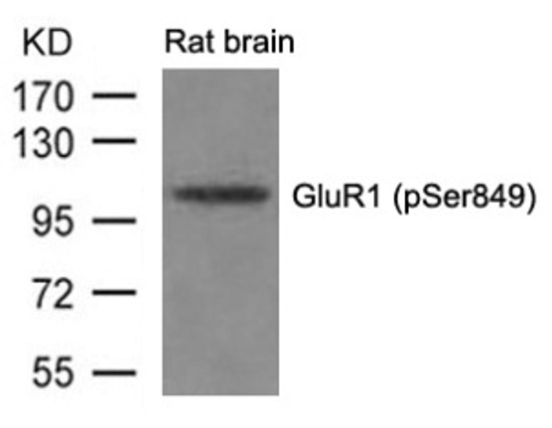 Western blot analysis of lysed extracts from Rat brain tissue using GluR1 (phospho-Ser849).