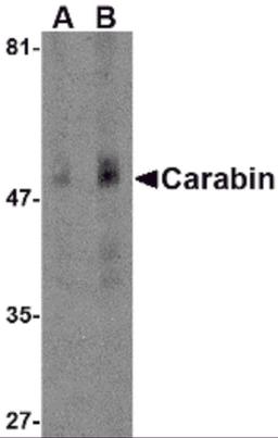 Western blot analysis of Carabin in human spleen tissue lysate with Carabin antibody at (A) 1 and (B) 2 &#956;g/mL.