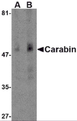 Western blot analysis of Carabin in human spleen tissue lysate with Carabin antibody at (A) 1 and (B) 2 μg/mL.