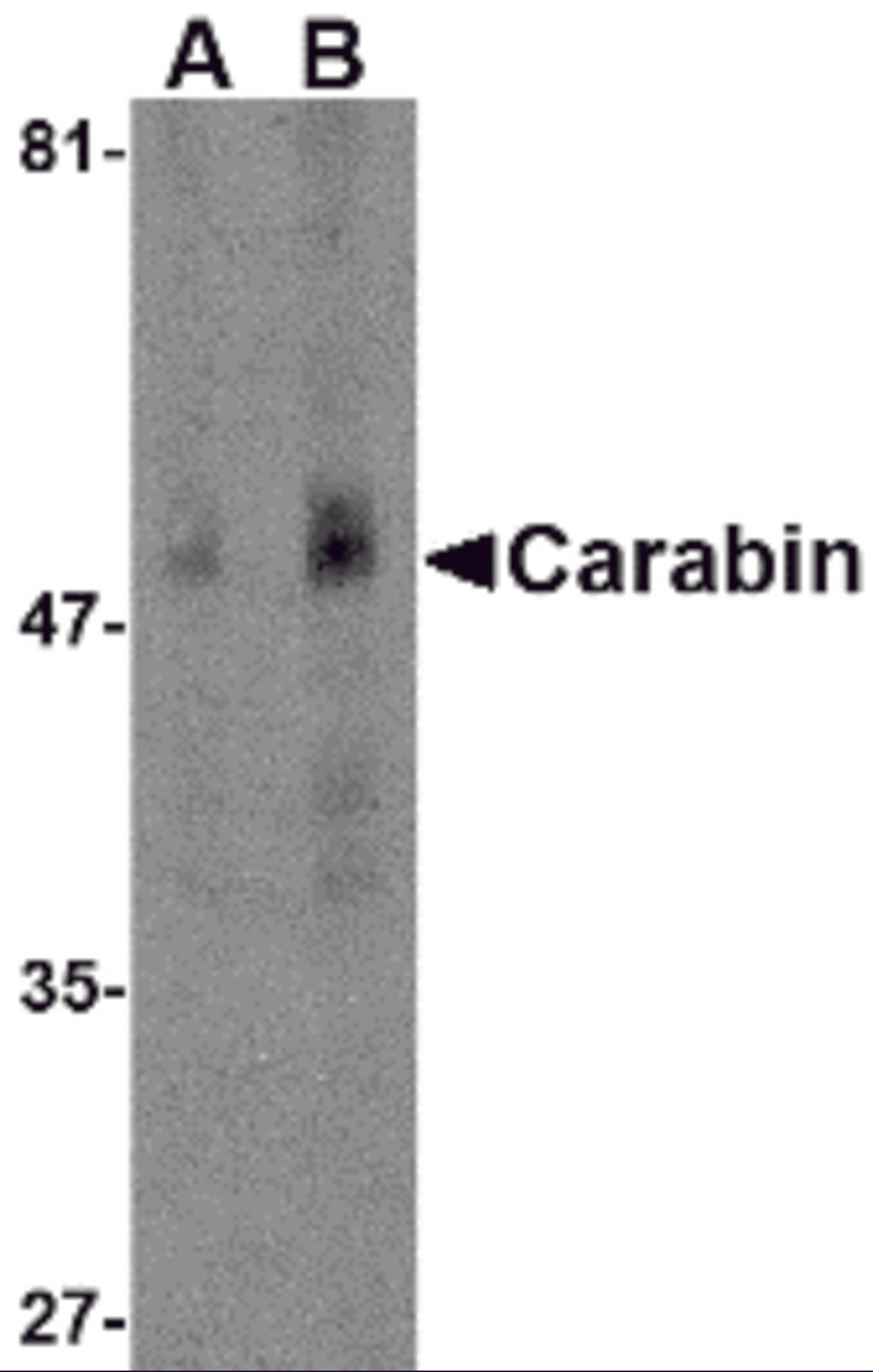 Western blot analysis of Carabin in human spleen tissue lysate with Carabin antibody at (A) 1 and (B) 2 μg/mL.