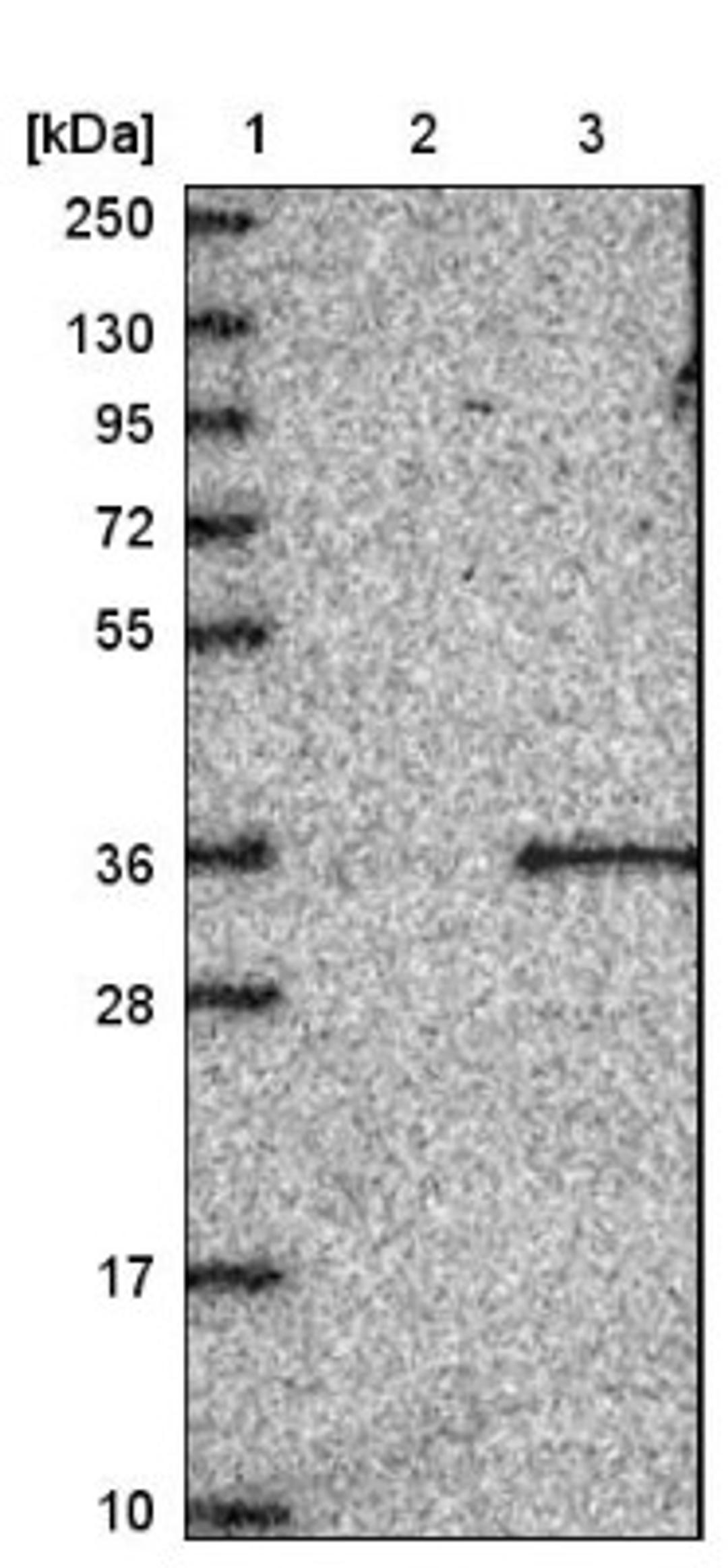 Immunohistochemistry: FAM207A Antibody [NBP1-90676] - Lane 1: Marker [kDa] 250, 130, 95, 72, 55, 36, 28, 17, 10<br/>Lane 2: Negative control (vector only transfected HEK293T lysate)<br/>Lane 3: Over-expression lysate (Co-expressed with a C-terminal myc-DDK tag (~3.1 kDa) in mammalian HEK293T cells, LY409226)