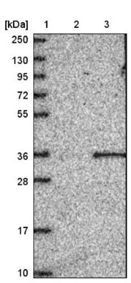 Immunohistochemistry: FAM207A Antibody [NBP1-90676] - Lane 1: Marker [kDa] 250, 130, 95, 72, 55, 36, 28, 17, 10<br/>Lane 2: Negative control (vector only transfected HEK293T lysate)<br/>Lane 3: Over-expression lysate (Co-expressed with a C-terminal myc-DDK tag (~3.1 kDa) in mammalian HEK293T cells, LY409226)