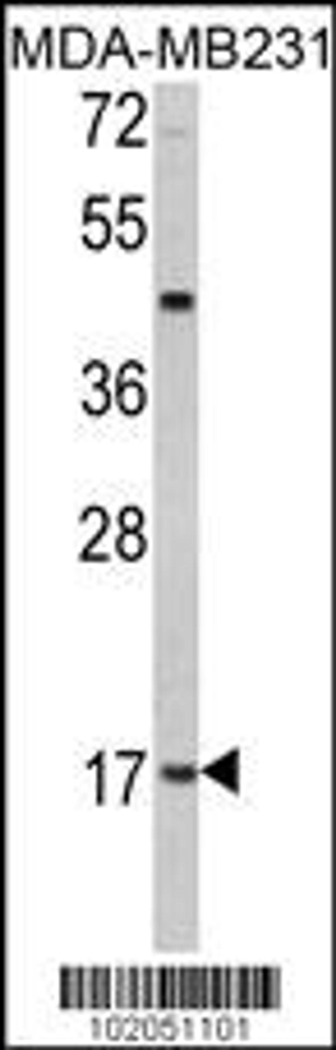 Western blot analysis of hLep-R149 in MDA-MB231 cell line lysates (35ug/lane)