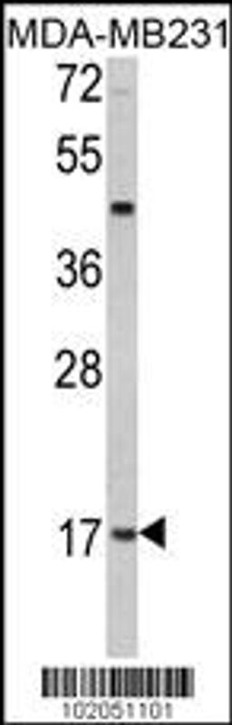 Western blot analysis of hLep-R149 in MDA-MB231 cell line lysates (35ug/lane)