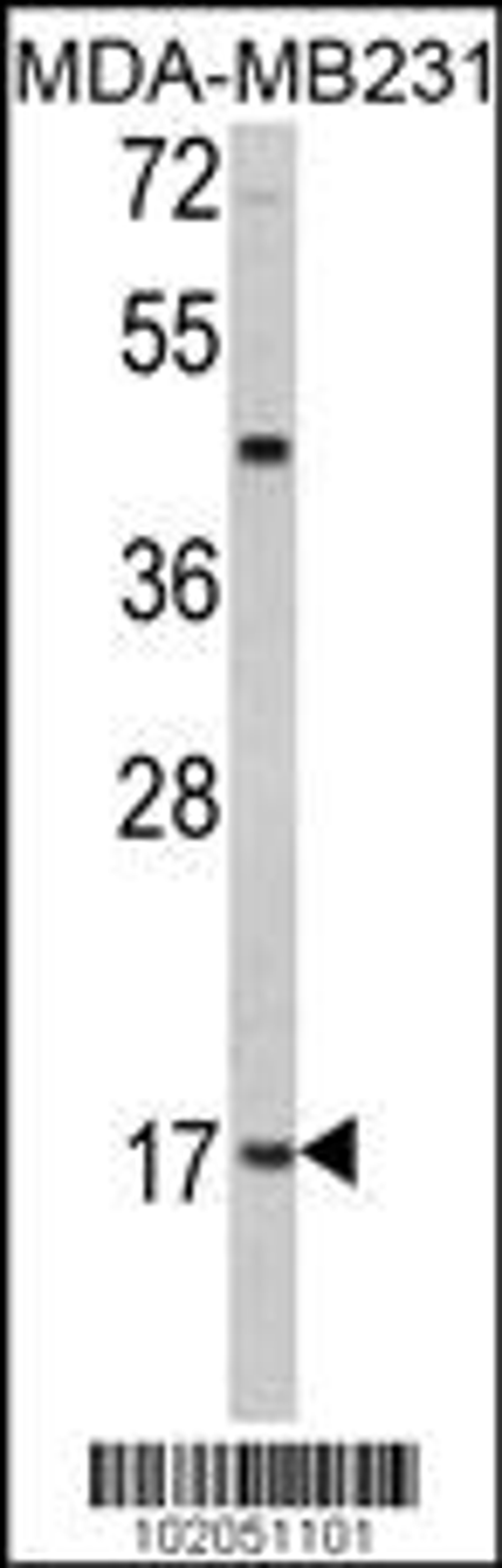 Western blot analysis of hLep-R149 in MDA-MB231 cell line lysates (35ug/lane)