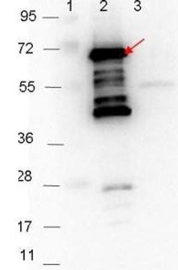 Western blot analysis of Lane 1: Molecular weight markers. Lane 2: MBP-p35 fusion protein (arrow; expected MW: 69.5 kDa). Lane 3: MBP alone using p35 antibody